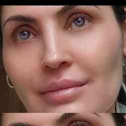 Single Albanian woman in London, UK, United Kingdom